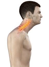 fix neck posture naturally at home