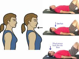 How to Integrate Chin Tucks into a Rehabilitation Routine