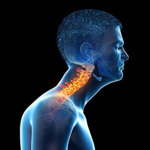 Long-Term Risks of Persistent Nerve Compression caused by forward head posture