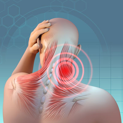 The Role of Forward Head Posture in Chronic Stress and Mental Fatigue